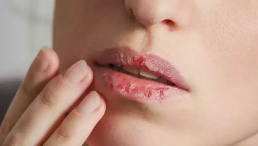 Dudak Yeme Oruçu Bozar mı? Bu Detaylar Bilinenleri Altüst Edecek!